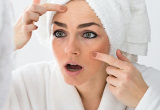 woman-shocked-with-acne